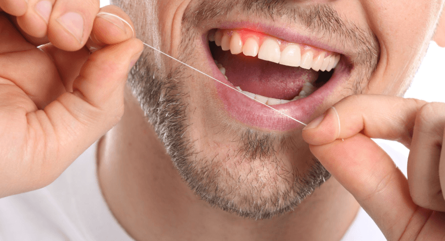 Why A Change In Flossing Resistance Deserves Attention