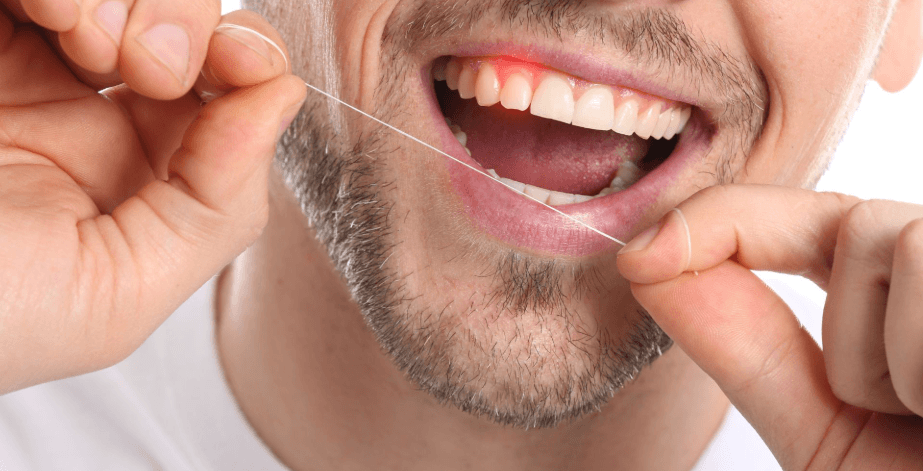 Why A Change In Flossing Resistance Deserves Attention